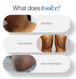 Natural Pigmentation Repair Cream